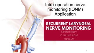 Intra-operation nerve
monitoring (IONM)
Application
General Surgery
IC: LOU KIN HENG
2023/04/14
1
 