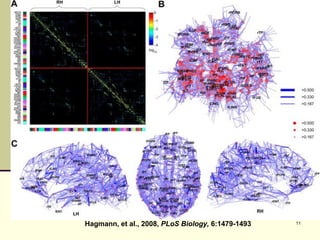 The Connectome - 2 Hagmann, et al., 2008,  PLoS Biology,  6:1479-1493 