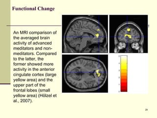 Functional  Change An MRI comparison of the averaged brain activity of advanced meditators and non-meditators. Compared to the latter, the former showed more activity in the anterior cingulate cortex (large yellow area) and the upper part of the frontal lobes (small yellow area) (Hölzel et al., 2007). 