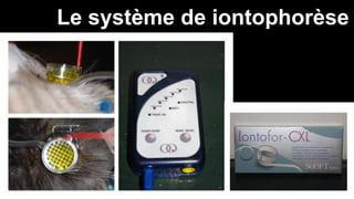 Le système de iontophorèse 
 