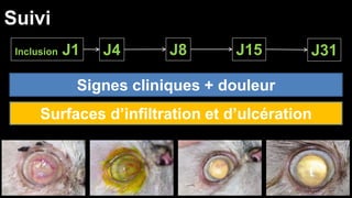 Suivi 
Inclusion J1 J4 J8 J15 J31 
Signes cliniques + douleur 
Surfaces d’infiltration et d’ulcération 
 