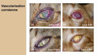 Vascularisation 
cornéenne 
 
