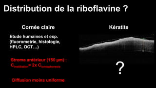 Distribution de la riboflavine ? 
Cornée claire Kératite 
Etude humaines et exp. 
(fluorometrie, histologie, 
HPLC, OCT…) 
Stroma antérieur (150 μm) : 
Cinstillation= 2x Ciontophoresis 
Diffusion moins uniforme 
? 
 