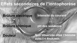 Effets secondaires de l’iontophorèse 
Brûlure electrique 
Intensité du courant 
Brûlure chimique pH des solutions 
Non observée chez l’homme 
avec I < 4mA/min 
Douleur 
 