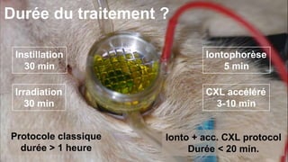 Durée du traitement ? 
Instillation 
30 min 
Iontophorèse 
5 min 
Irradiation 
30 min 
CXL accéléré 
3-10 min 
Protocole classique 
durée > 1 heure 
Ionto + acc. CXL protocol 
Durée < 20 min. 
 