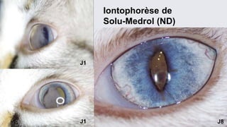 Iontophorèse de 
Solu-Medrol (ND) 
J1 
J1 J8 
 