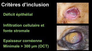 Critères d’inclusion 
Déficit épithélial 
Infiltration cellulaire et 
fonte stromale 
Epaisseur cornéenne 
Minimale > 300 μm (OCT) 
 