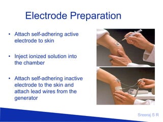 Electrode Preparation
• Attach self-adhering active
electrode to skin
• Inject ionized solution into
the chamber
• Attach self-adhering inactive
electrode to the skin and
attach lead wires from the
generator
Sreeraj S R

 