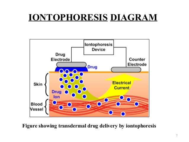 Image result for Iontophoresis