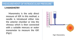 MEASUREMENT OF INTRAOCULAR PRESSURE
1.MANOMETRY
Manometry is the only direct
measure of IOP. In this method, a
needle is introduced either into
the anterior chamber or into the
vitreous which is then connected
with a suitable mercury or water
manometer to measure the IOP.
(Fig3.)
Fig3. Manometry.
 