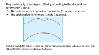 They are broadly of two types, differing according to the shape of the
deformation (Fig.4.):
• The indentation or impression tonometers (truncated cone) and
• The applanation tonometers (simple flattening).
Fig4. Corneal deformation created by (A) indentation tonometers (a truncated cone) and
(B) applanation tonometers (simple flattening).
 