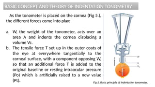 BASIC CONCEPT AND THEORY OF INDENTATION TONOMETRY
As the tonometer is placed on the cornea (Fig 5.),
the different forces come into play:
a. W, the weight of the tonometer, acts over an
area A and indents the cornea displacing a
volume Vc.
b. The tensile force T set up in the outer coats of
the eye at everywhere tangentially to the
corneal surface, with a component opposing W,
so that an additional force T is added to the
original baseline or resting intraocular pressure
(Po) which is artificially raised to a new value
(Pt). Fig 5. Basic principle of indentation tonometer.
 