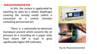 PNEUMOTONOMETER
In this, the cornea is applanated by
touching its apex by a silastic diaphragm
covering the sensing nozzle (which is
connected to a central chamber
containing pressurised air).
There is a pneumatic-to-electronic
transducer present which converts the air
pressure to a recording on a paper strip,
from where IOP is read. It gives
significantly higher IOP estimates.
Fig 16. Pneumotonometer
 