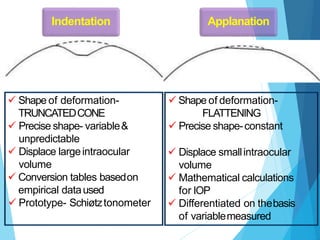 Intraocular pressure presentation in beh | PPTX