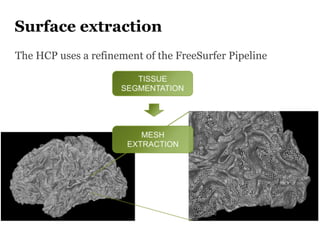 Surface extraction
The HCP uses a refinement of the FreeSurfer Pipeline
 