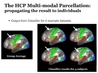 The HCP Multi-modal Parcellation:
propagating the result to individuals
• Output from Classifier for 4 example datasets
Gr...
