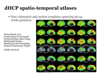 dHCP spatio-temporal atlases
• New volumetric and surface templates spanning 36-44
weeks gestation
Jelena Bozek et al.
Con...