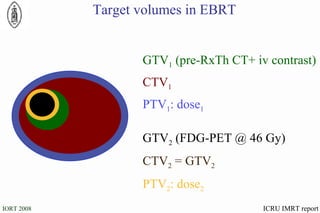 CTV 2  = GTV 2 ICRU IMRT report Target volumes in EBRT PTV 1 : dose 1   CTV 1   GTV 1  (pre-RxTh CT+ iv contrast) PTV 2 : dose 2   GTV 2  (FDG-PET @ 46 Gy) 