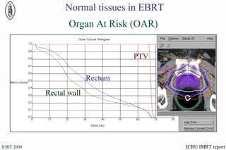 Organ At Risk (OAR) PTV Rectal wall Rectum ICRU IMRT report Normal tissues in EBRT 