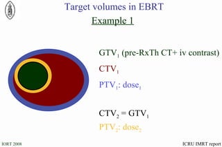 Example 1 ICRU IMRT report Target volumes in EBRT PTV 1 : dose 1   CTV 1   PTV 2 : dose 2   GTV 1  (pre-RxTh CT+ iv contrast) CTV 2  = GTV 1 