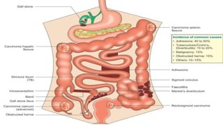 Patho Intestinal Obstruction Intestinal obstruction cause pathophysiology seminar.pptx