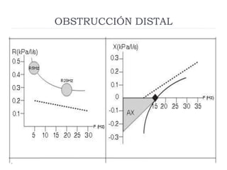 OBSTRUCCIÓN DISTAL
 