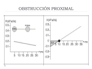 OBSTRUCCIÓN PROXIMAL
 
