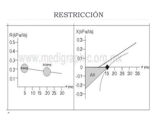 RESTRICCIÓN
 