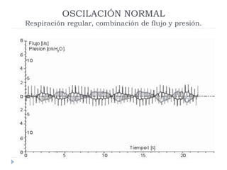OSCILACIÓN NORMAL
Respiración regular, combinación de flujo y presión.
 