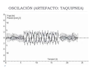 OSCILACIÓN (ARTEFACTO: TAQUIPNEA)
 