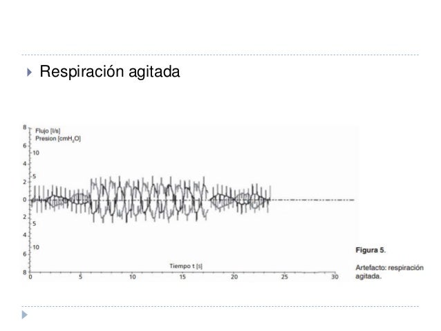 Oscilometría de Impulso