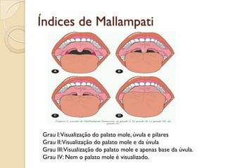 Índices de Mallampati




Grau I:Visualização do palato mole, úvula e pilares
Grau II:Visualização do palato mole e da úvula
Grau III:Visualização do palato mole e apenas base da úvula.
Grau IV: Nem o palato mole é visualizado.
 