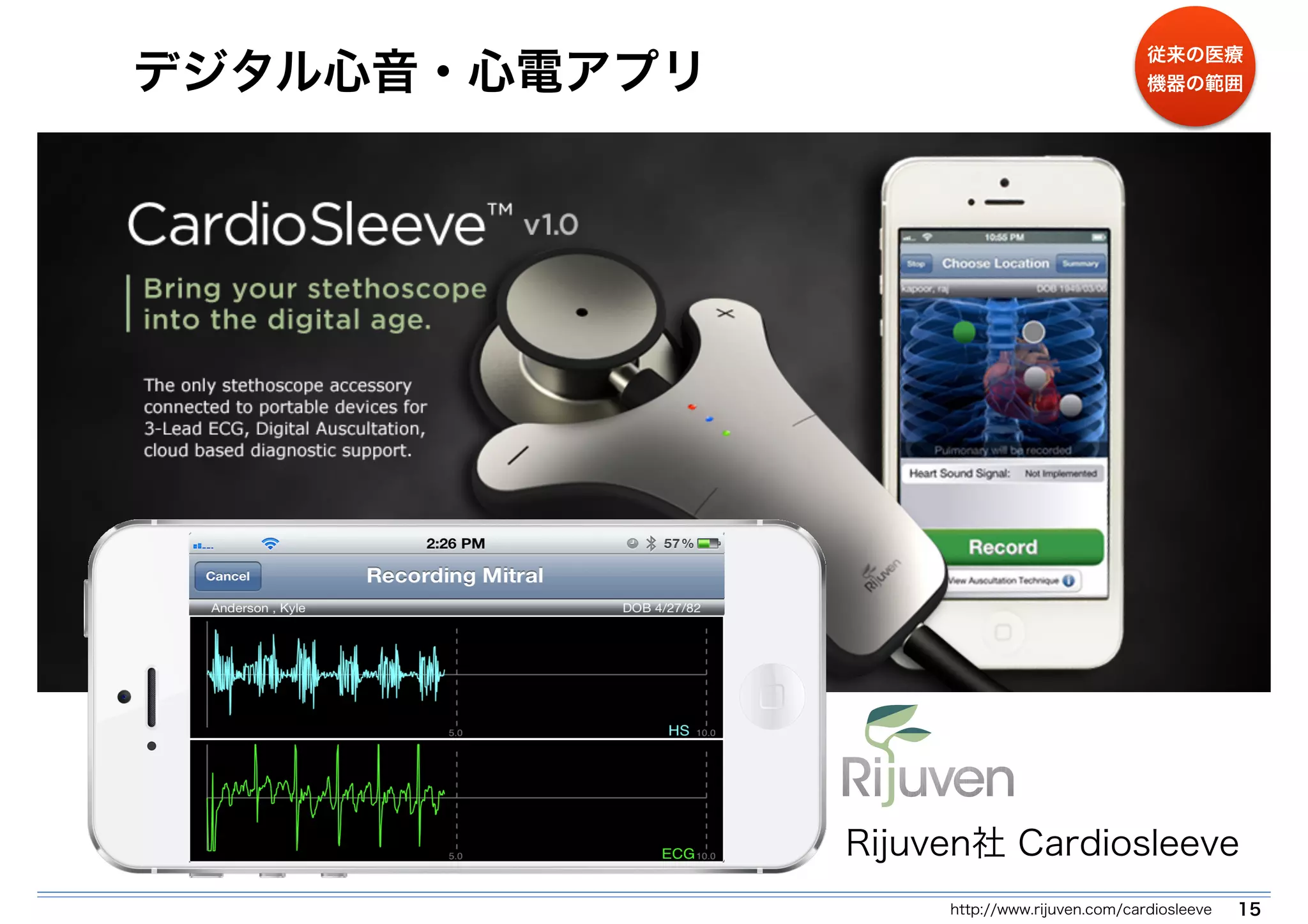 デジタル心音・心電アプリ 
従来の医療 
機器の範囲 
Rijuven社 Cardiosleeve 
http://www.rijuven.com/cardiosleeve 15 
 