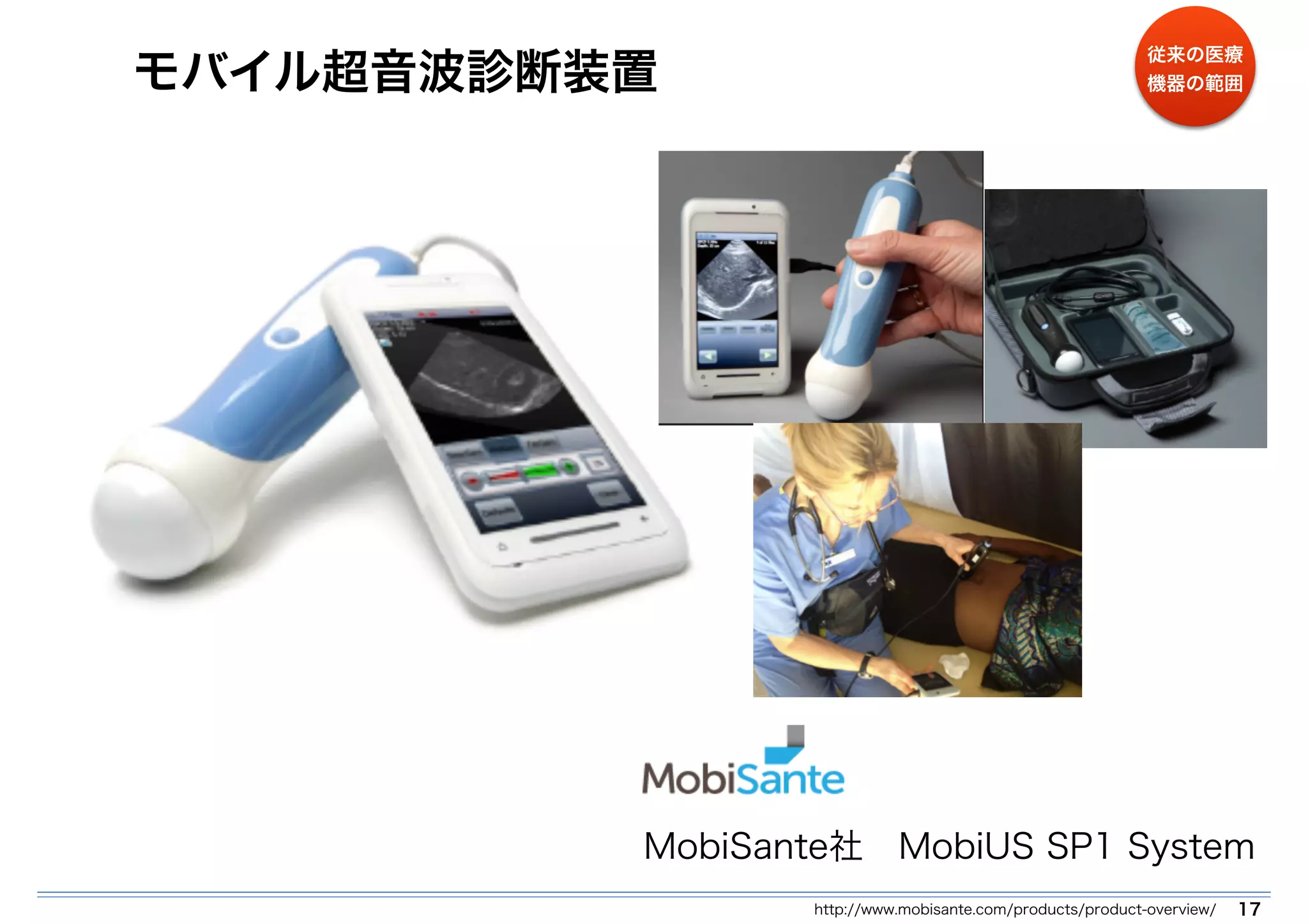 モバイル超音波診断装置 
従来の医療 
機器の範囲 
MobiSante社　MobiUS SP1 System 
http://www.mobisante.com/products/product-overview/ 17 
 