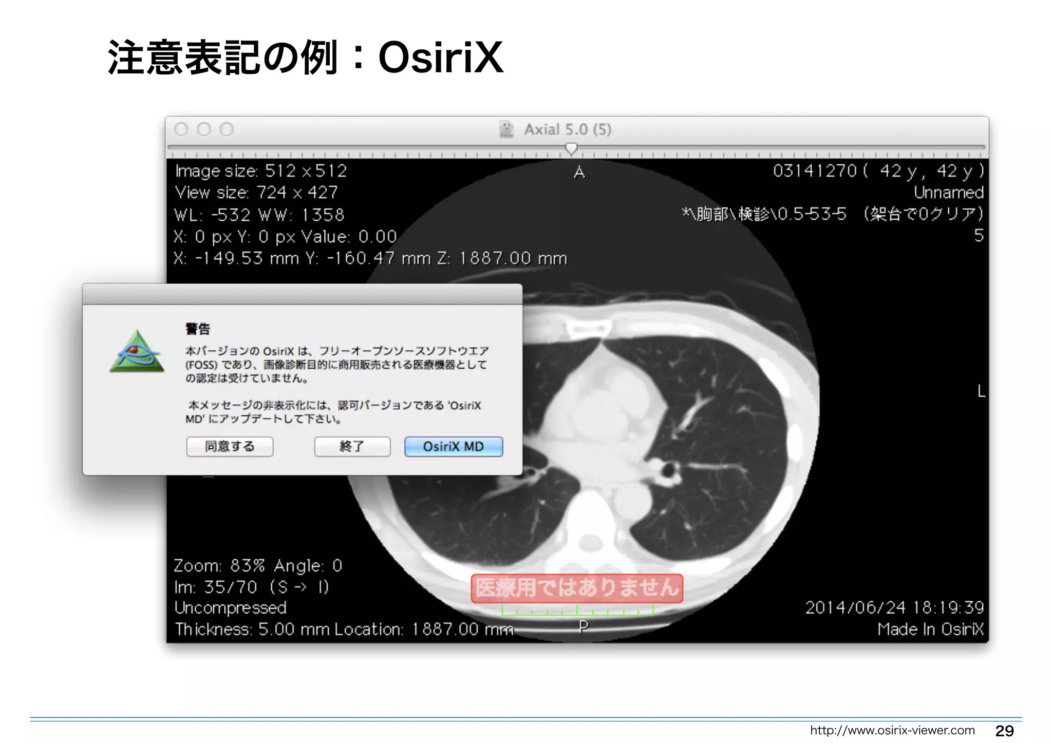 注意表記の例：OsiriX 
http://www.osirix-viewer.com 29 
 
