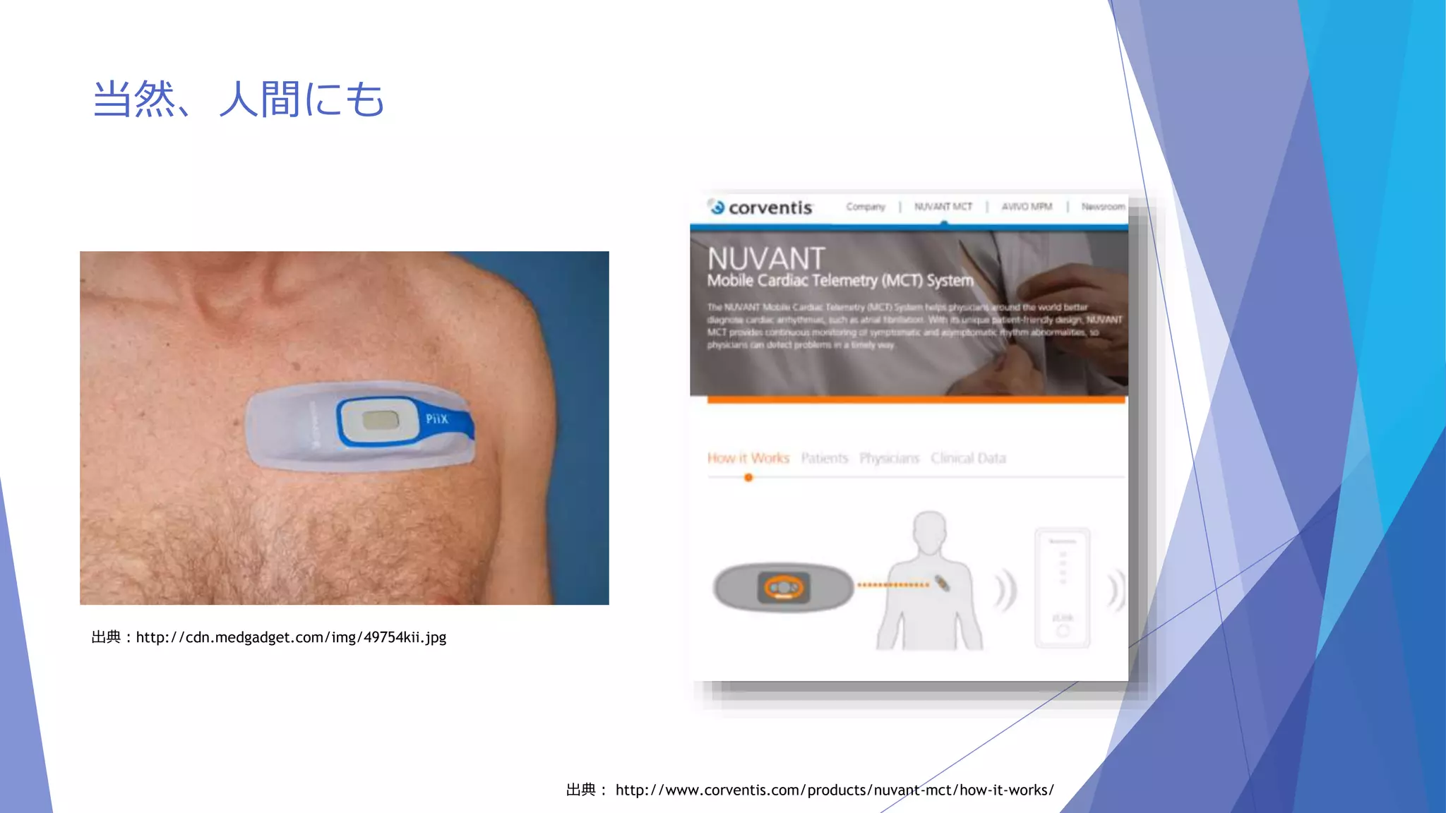 当然、人間にも 
出典：http://cdn.medgadget.com/img/49754kii.jpg 
出典： http://www.corventis.com/products/nuvant-mct/how-it-works/ 
 