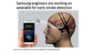 Samsung engineers are working on
wearable for early stroke detection
8
Source: Early Detection Sensor and Algorithm Package (EDSAP)
 