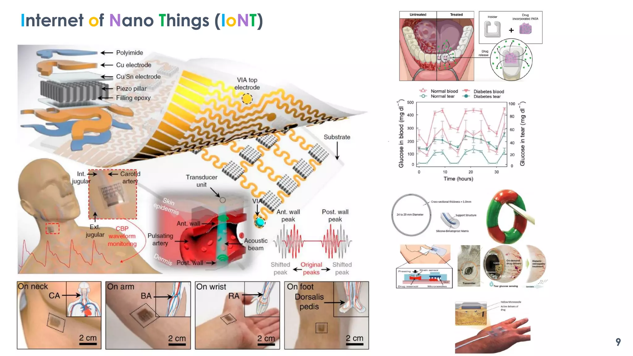 9
Internet of Nano Things (IoNT)
 