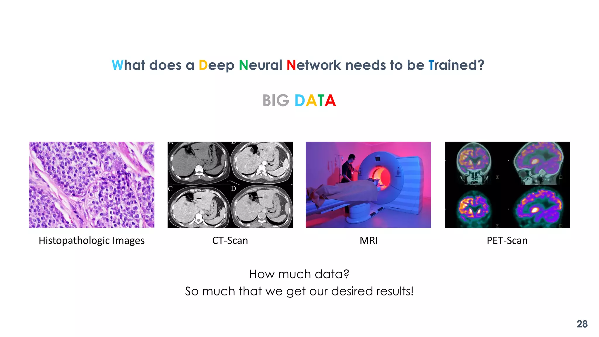 Histopathologic Images CT-Scan MRI PET-Scan
What does a Deep Neural Network needs to be Trained?
BIG DATA
How much data?
So much that we get our desired results!
28
 