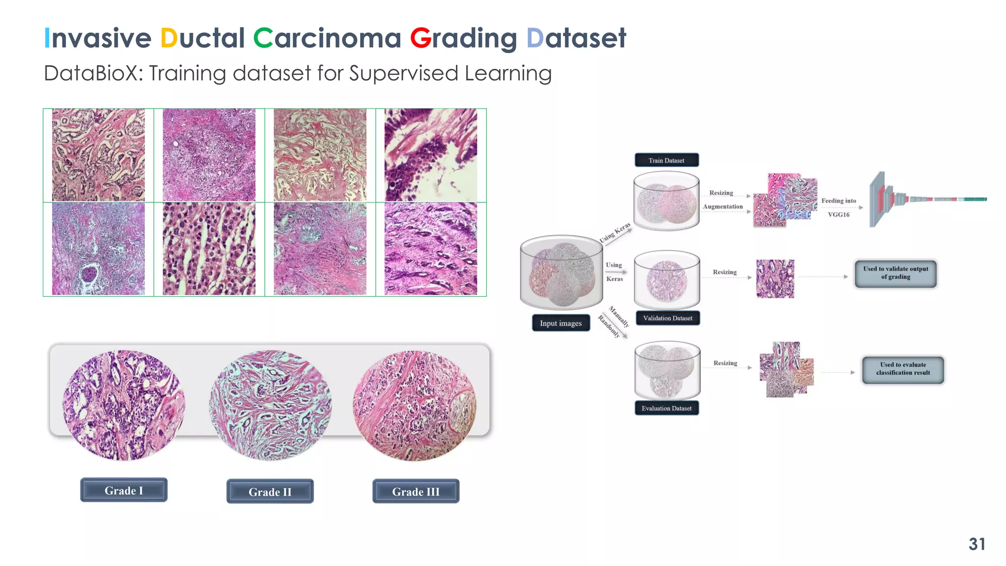 Grade I Grade II Grade III
Invasive Ductal Carcinoma Grading Dataset
DataBioX: Training dataset for Supervised Learning
31
 