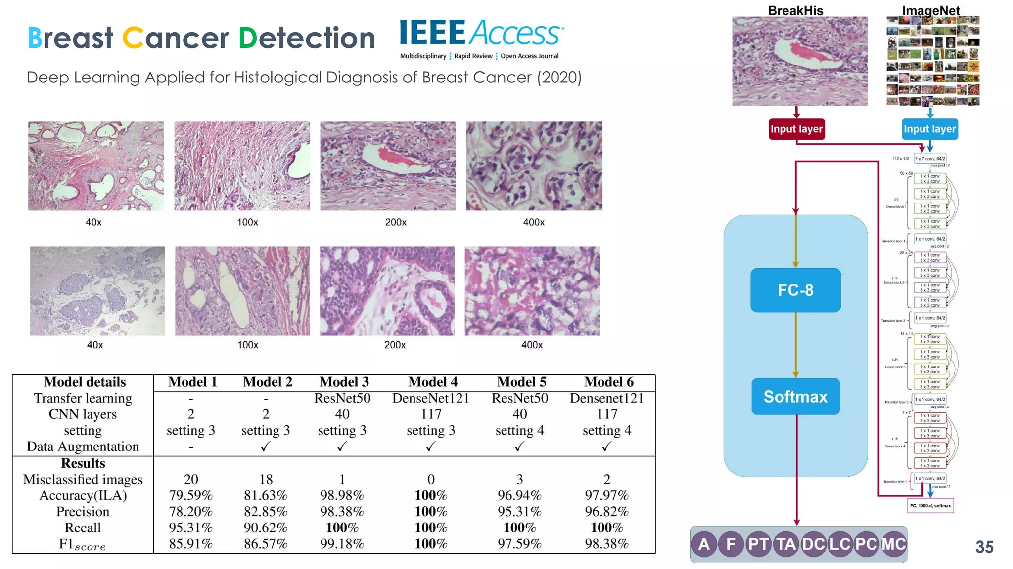 Breast Cancer Detection
Deep Learning Applied for Histological Diagnosis of Breast Cancer (2020)
35
 