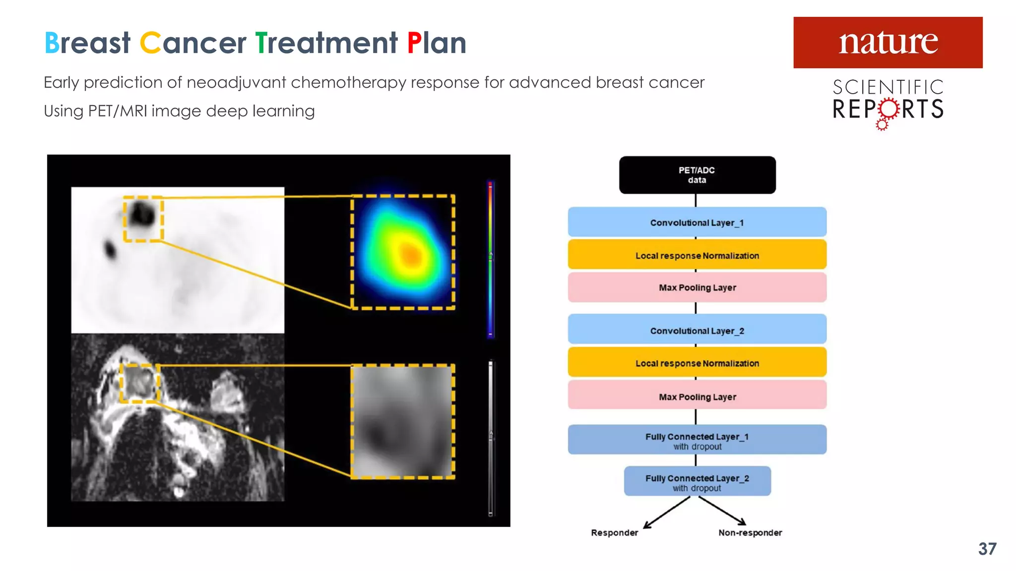 Breast Cancer Treatment Plan
Early prediction of neoadjuvant chemotherapy response for advanced breast cancer
Using PET/MRI image deep learning
37
 