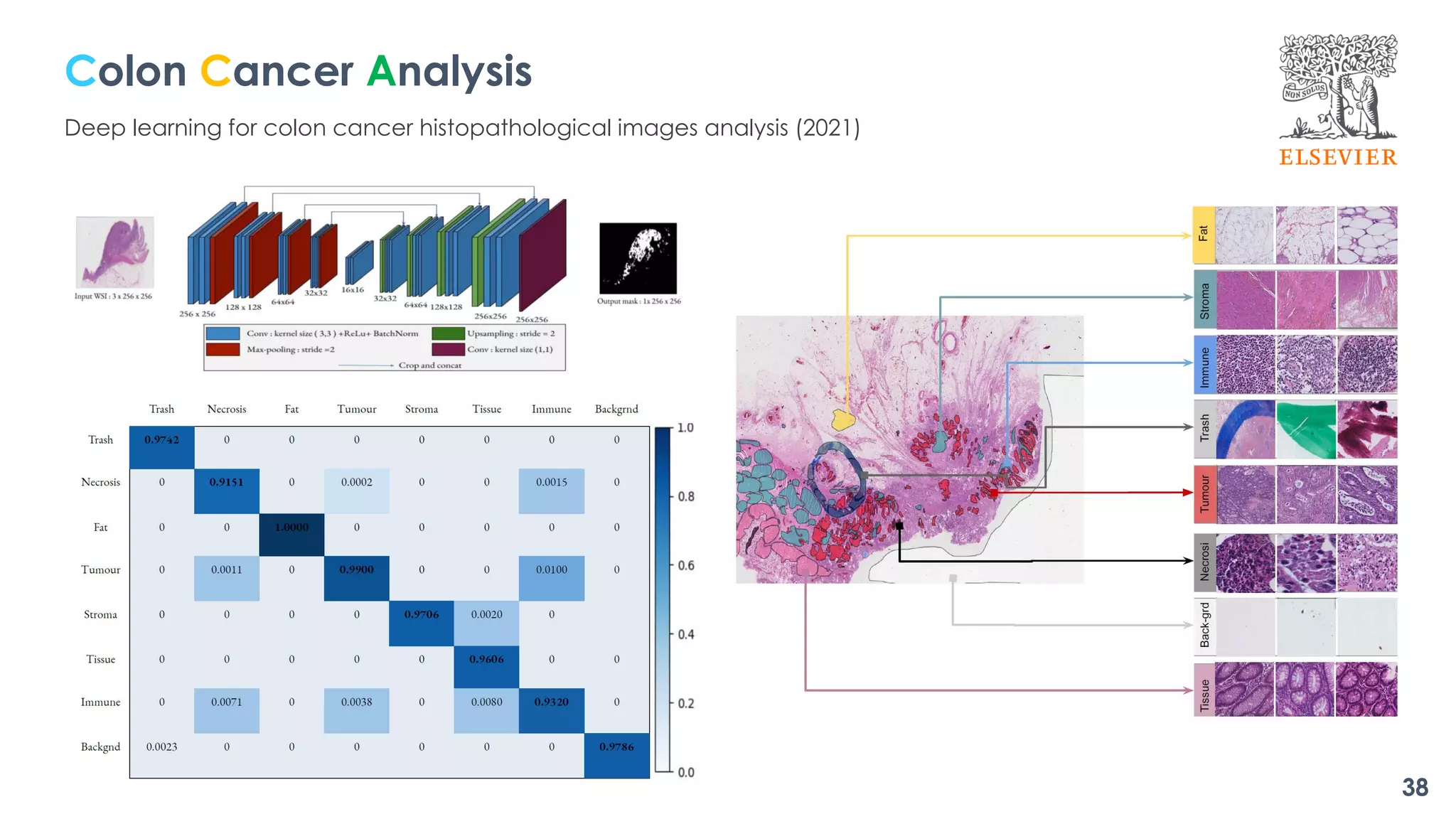 Colon Cancer Analysis
Deep learning for colon cancer histopathological images analysis (2021)
38
 