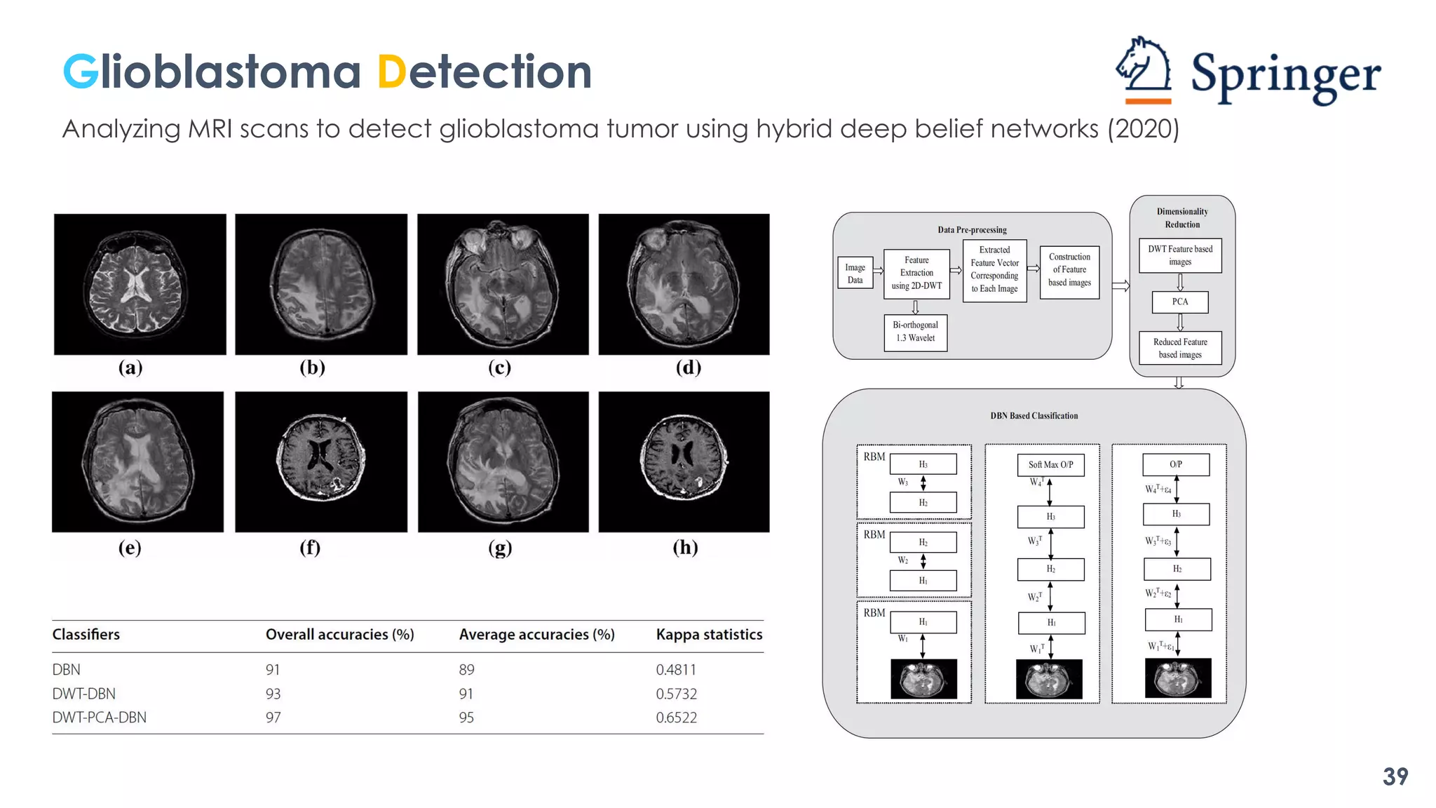 Glioblastoma Detection
Analyzing MRI scans to detect glioblastoma tumor using hybrid deep belief networks (2020)
39
 