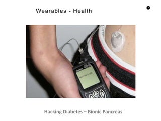 10
Wearables - Health
Hacking Diabetes – Bionic Pancreas
 