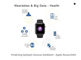 29
Wearables & Big Data - Health
Predicting Epileptic Seizures EpiWatch - Apple ResearchKit
 