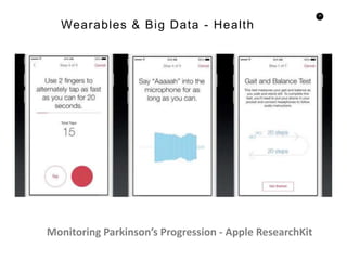 30
Wearables & Big Data - Health
Monitoring Parkinson’s Progression - Apple ResearchKit
 