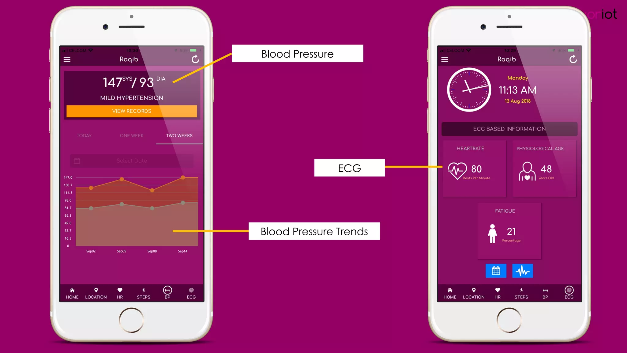 favoriot
Blood Pressure
ECG
Blood Pressure Trends
 