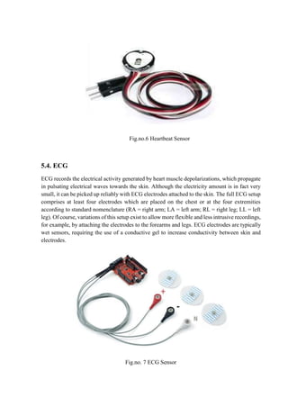 Ecg Sensor Pdf IOT_BASED_PATIENT_MONITORING_SYSTEM_Anan.docx