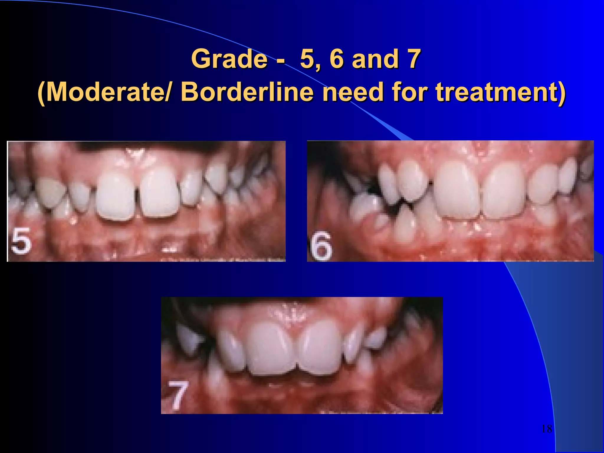 The Impact Of Spee And Wilson Curves On Your Orthodontic Treatment - xnf2jzg